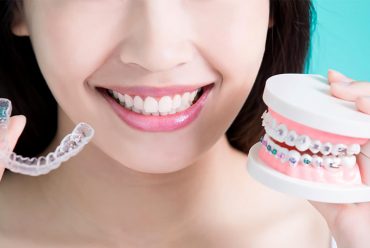 Tratamento com Invisalign ou aparelho fixo? Veja qual é mais indicado para cada situação